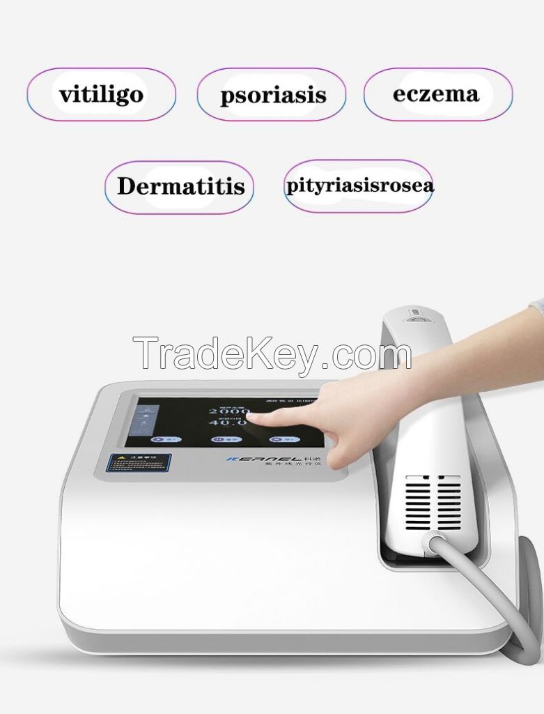 Excimer Laser 308nm Psoriasis Vitiligo Laser Machine 308nm Excimer Laser effective treatment for skin disorders in dermatology 