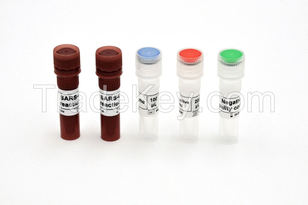 New Coronavirus (2019-nCoV) Nucleic Acid Detection Kit (RT PCR method)