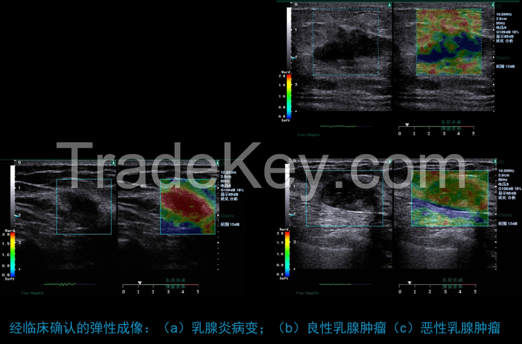 4D Color Doppler Ultrasound Scanner