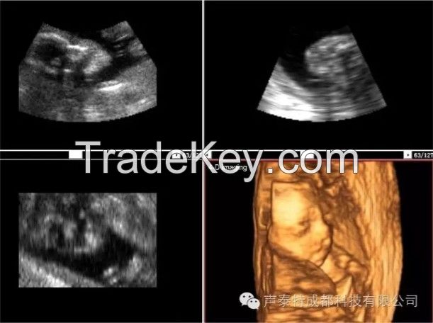 4D Color Doppler Ultrasound Scanner