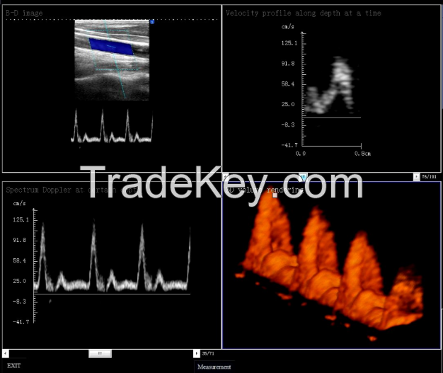 4D Color Doppler Ultrasound Scanner