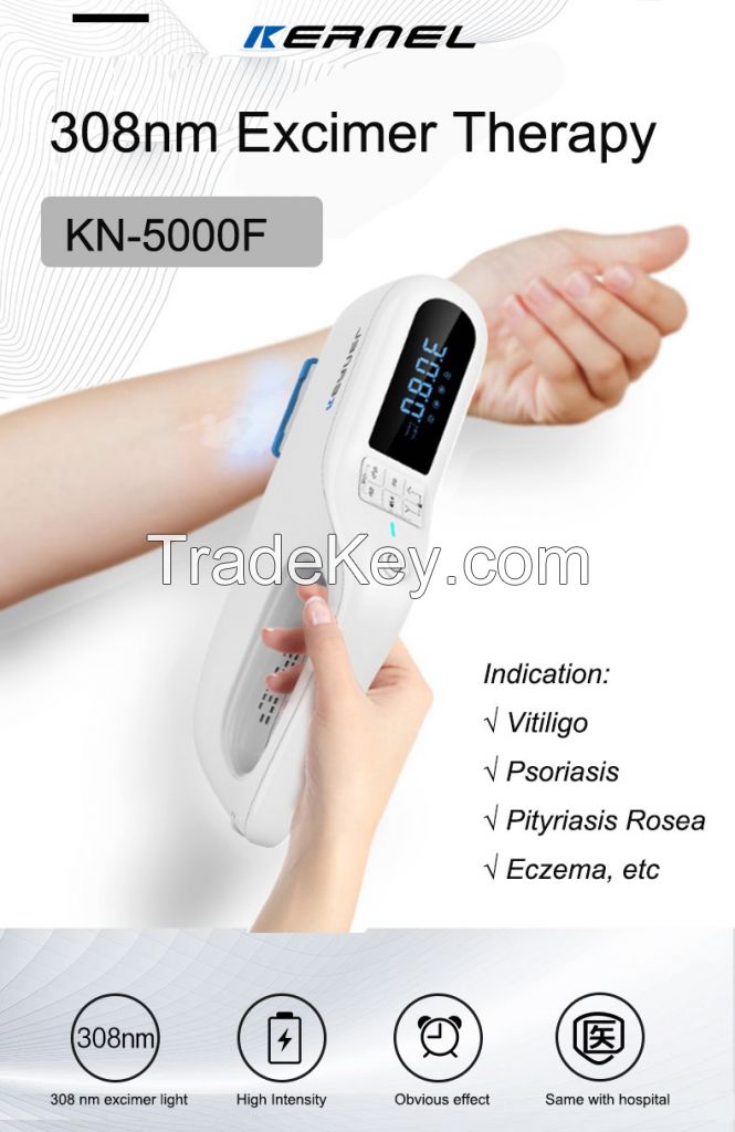 Handheld 308nm UVB Phototherapy 308 nm excimer laser