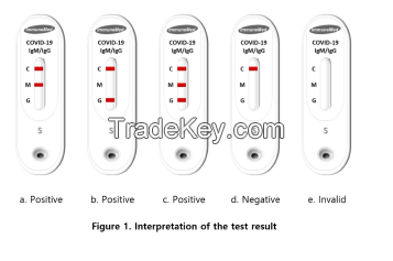 Coronavirus diagnostic kit