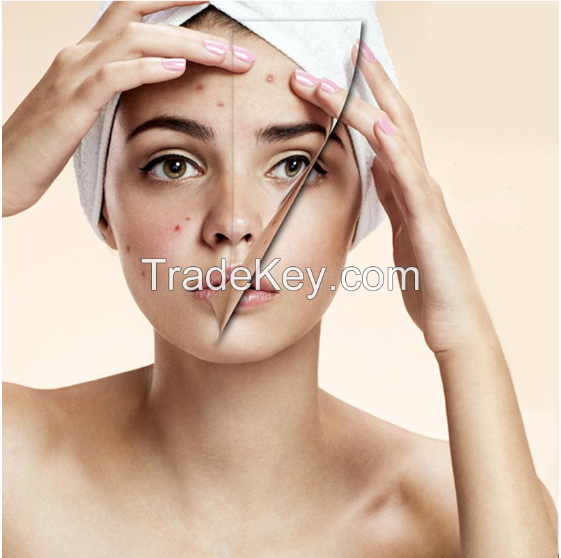 AKNICARE Lotion /  Acne prone skin