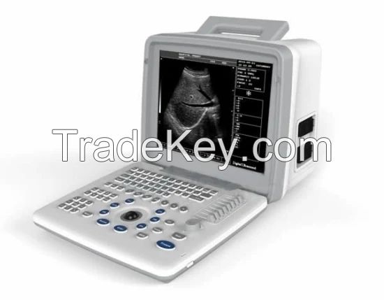 Portable B/W Ultrasound Scanner with Clear Image Quality