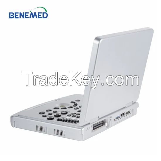 Laptop Notebook Ultrasound Scanner Color Doppler 3D 4D