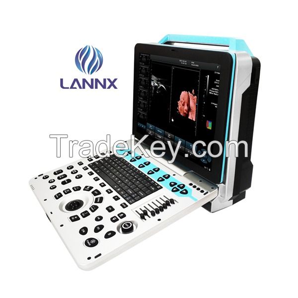 LANNX uDult P5 PRO 3D/4D/5D Portable color doppler ultrasound scanner