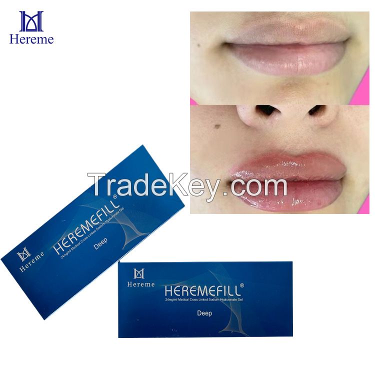 2022 Hot Popular Deep Injectable Ha Filling The Nose Chin Cheek Dermal Filler