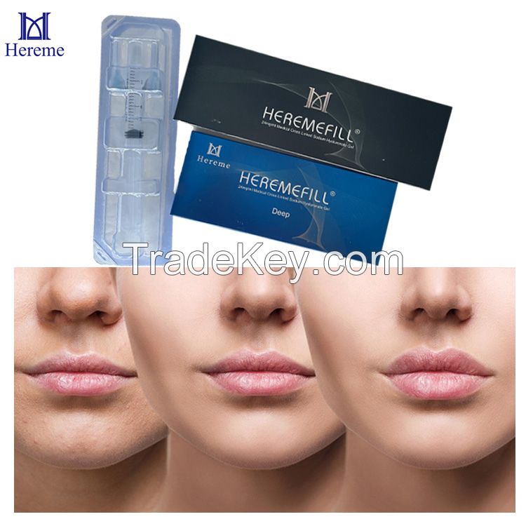 2022 Hot Popular Deep Injectable Ha Filling The Nose Chin Cheek Dermal Filler