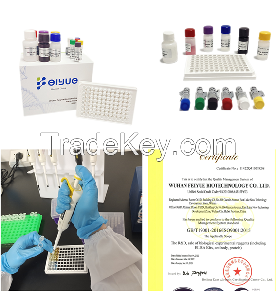 Human anti-immunodeficiency virus antibody,HIV ELISA Kit