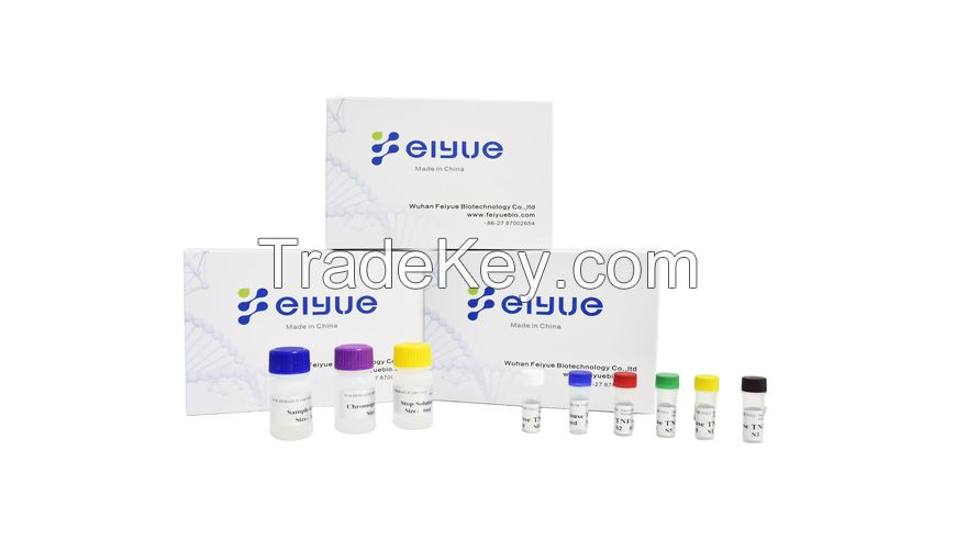 Human IL-20(Interleukin 20) ELISA Kit