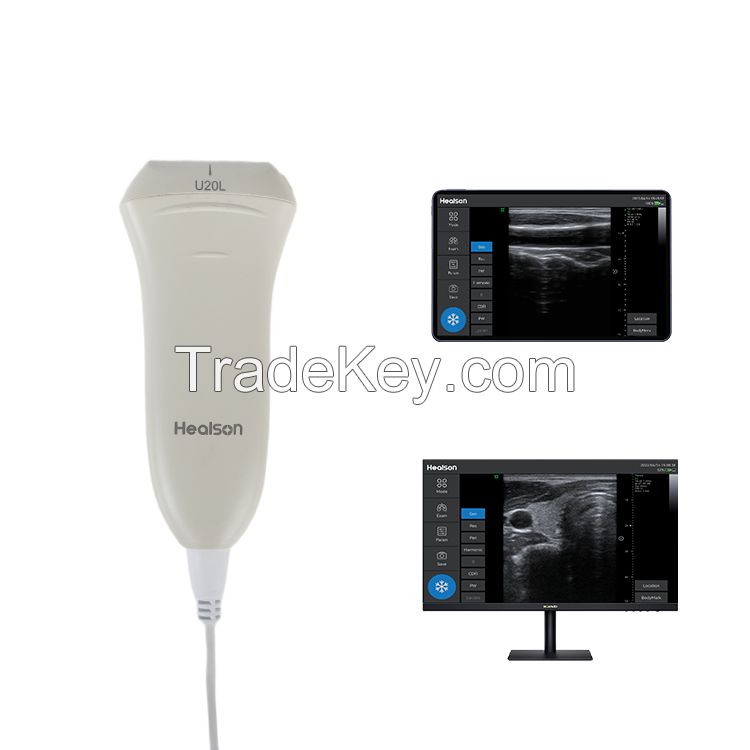 Handheld Linear Probe Machine Diagnostic doppler ultrasound scanner