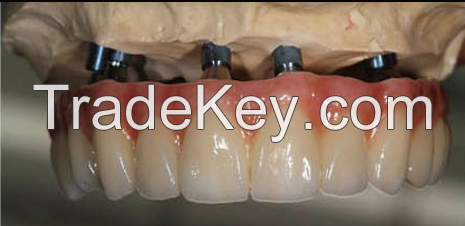 Dental Treatment Dental Metal Ceramic Crown Made  Dental Lab in