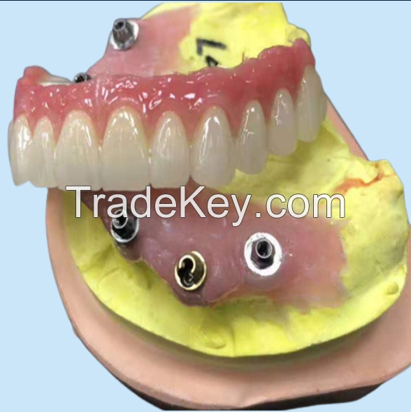 Porcelain-Fused-to-Metal (PFM) Crowns - China Dental Lab