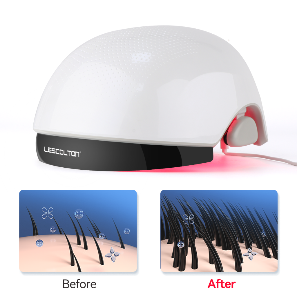 Lescolton 2022 New Arrival Hair Regrowth Laser Helmet Anti Hair Loss Treatment Hair Loss Laser Therapy