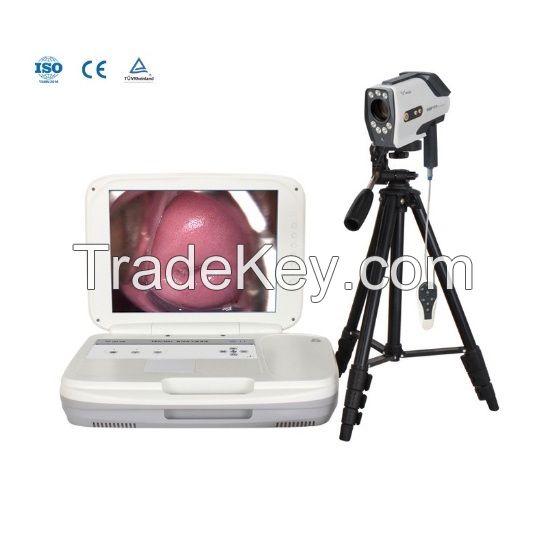 Laptop Electronic Digital Colposcope