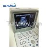 Portable B/W Ultrasound Scanner with Clear Image Quality