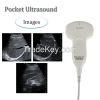 Portable Medical Ultrasound Instruments Color Doppler Ultrasound