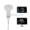 Portable Medical Ultrasound Instruments Color Doppler Ultrasound