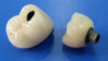 Dental CAD/CAM Wieland &amp; Lava &amp; Cercon Zirconia all ceramic aesthetic crown