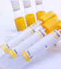 Gel&amp;Clot Activator Tubes Evacuated Blood Collection Serum Tube, Test Tube For Blood Sample Colletion (CE)