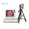 Laptop Electronic Digital Colposcope