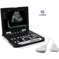 LANNX uRason N50 Digital B Ultrsound-Notebook