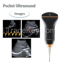 Healson C30C Pocket Handheld High Resolution Color Doppler Ultrasound