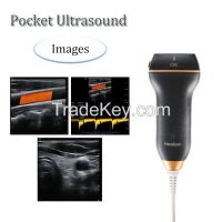 Healson Color Doppler Mini Handheld USB Linear Probe Portable Ultrasou