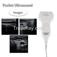 Pocket Linear Handheld Digital Ultrasound Probe Portable USG Machine