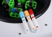 L-600A Tabletop Centrifuge Lab Centrifuge PRP kit Centrifuge