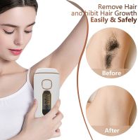 IPL Hair Removal for Women at Home Use Painless Permanent on Whole Body Facial Laser Hair Removal 999, 999 Flashes