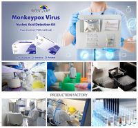 American Europe Monkeypox Virus antigen detection test kit